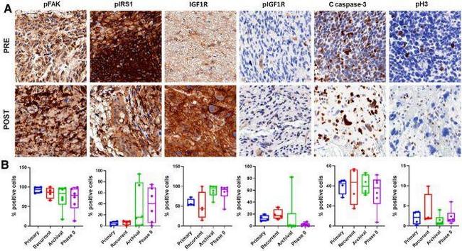 Phospho-IRS1 (Tyr612) Antibody in Immunohistochemistry (PFA fixed) (IHC (PFA))