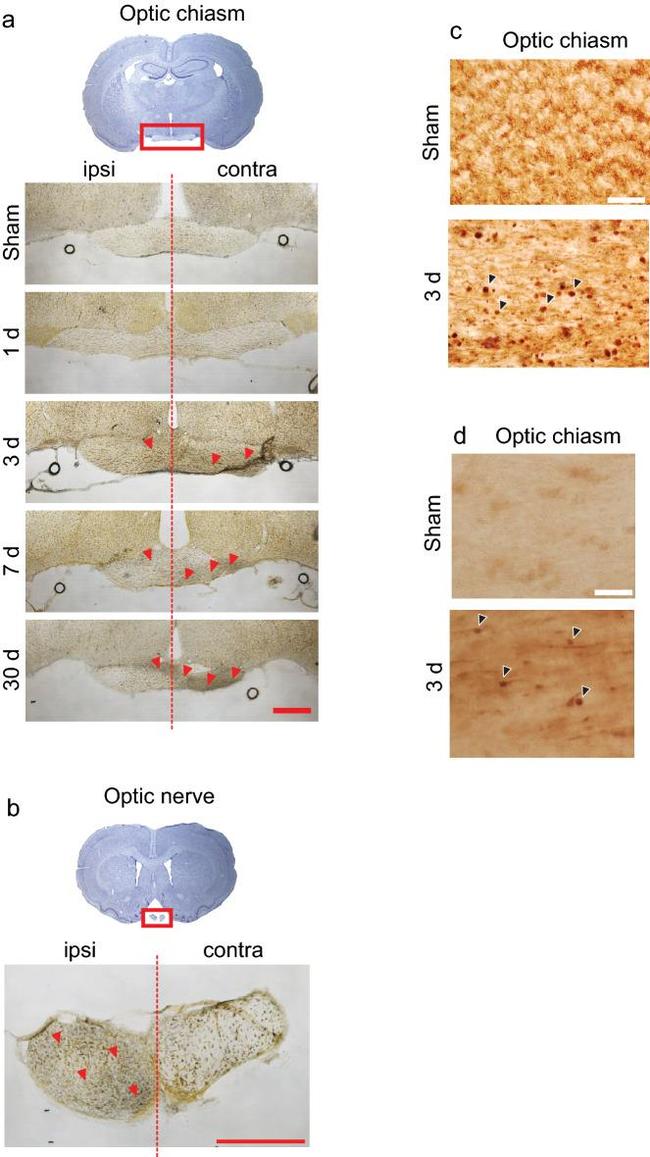 beta Amyloid Antibody in Immunohistochemistry (IHC)