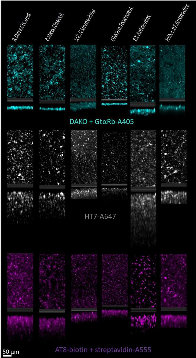 Tau Antibody in Immunohistochemistry (IHC)