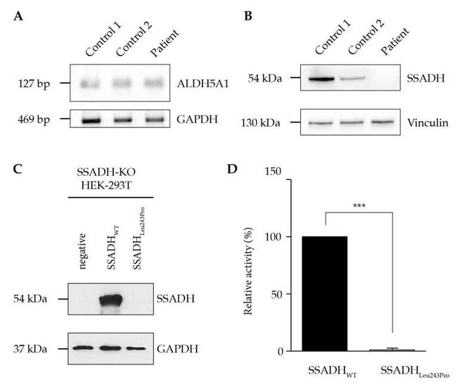 Vinculin Antibody in Western Blot (WB)