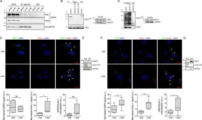 TAK1 Antibody in Western Blot, Immunoprecipitation (WB, IP)