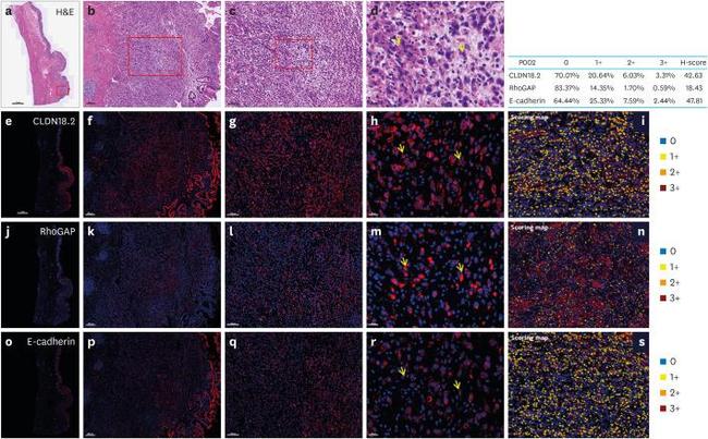 Claudin 18 Antibody in Immunohistochemistry (IHC)