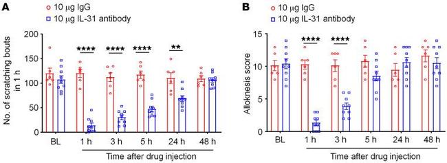 IL-31 Antibody in Neutralization (Neu)