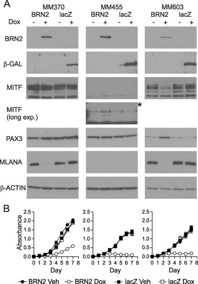 PAX3 Antibody in Western Blot (WB)