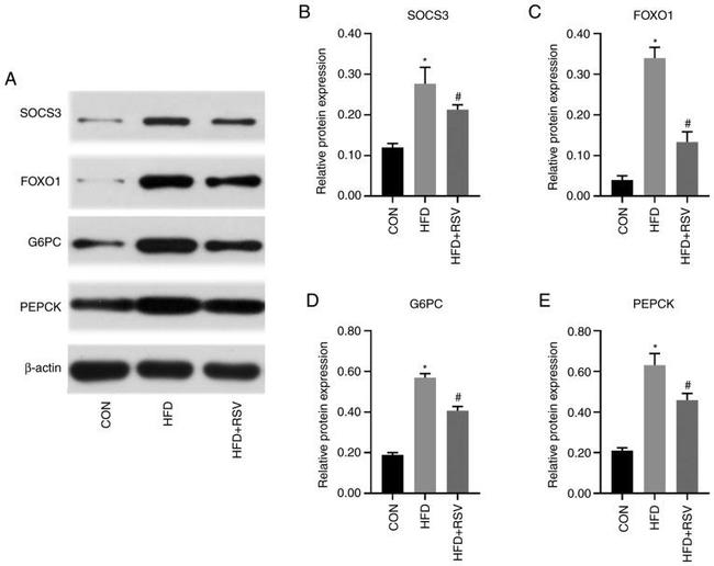 PCK2 Antibody in Western Blot (WB)