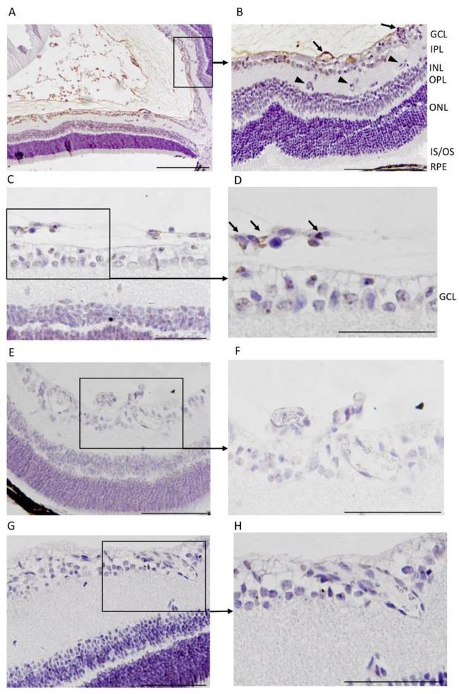 FITC Antibody in Immunohistochemistry (IHC)