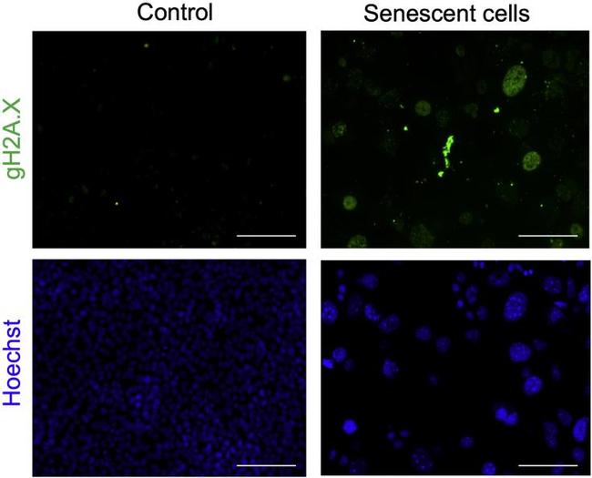 Alexa Fluor 488 Antibody in Immunocytochemistry (ICC/IF)