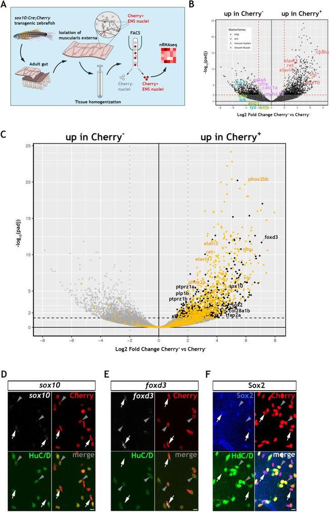 HuC/HuD Antibody in Immunohistochemistry (IHC)