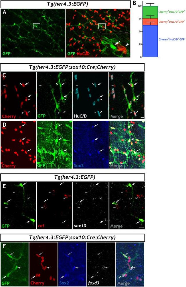 HuC/HuD Antibody in Immunohistochemistry (IHC)