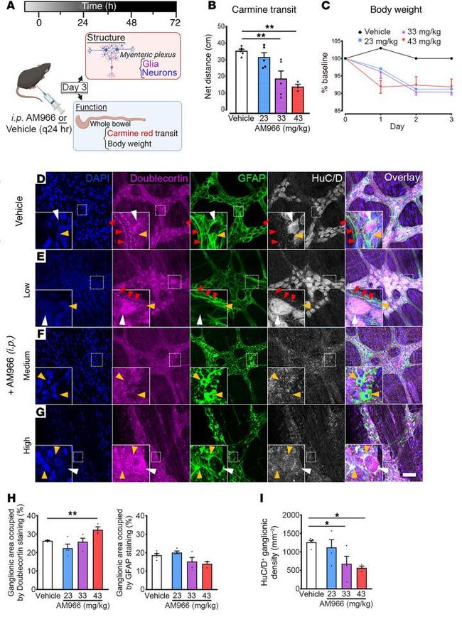 HuC/HuD Antibody in Immunohistochemistry (IHC)