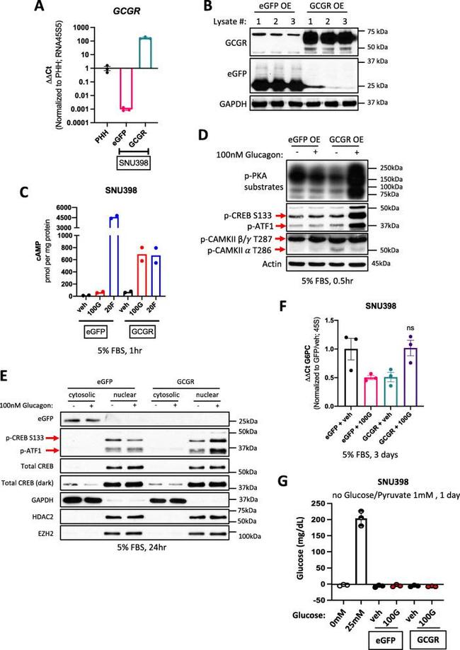 Glucagon Receptor Antibody in Western Blot (WB)