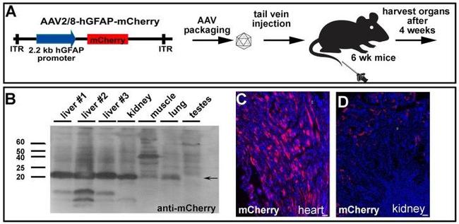 mCherry Antibody in Immunohistochemistry (IHC)