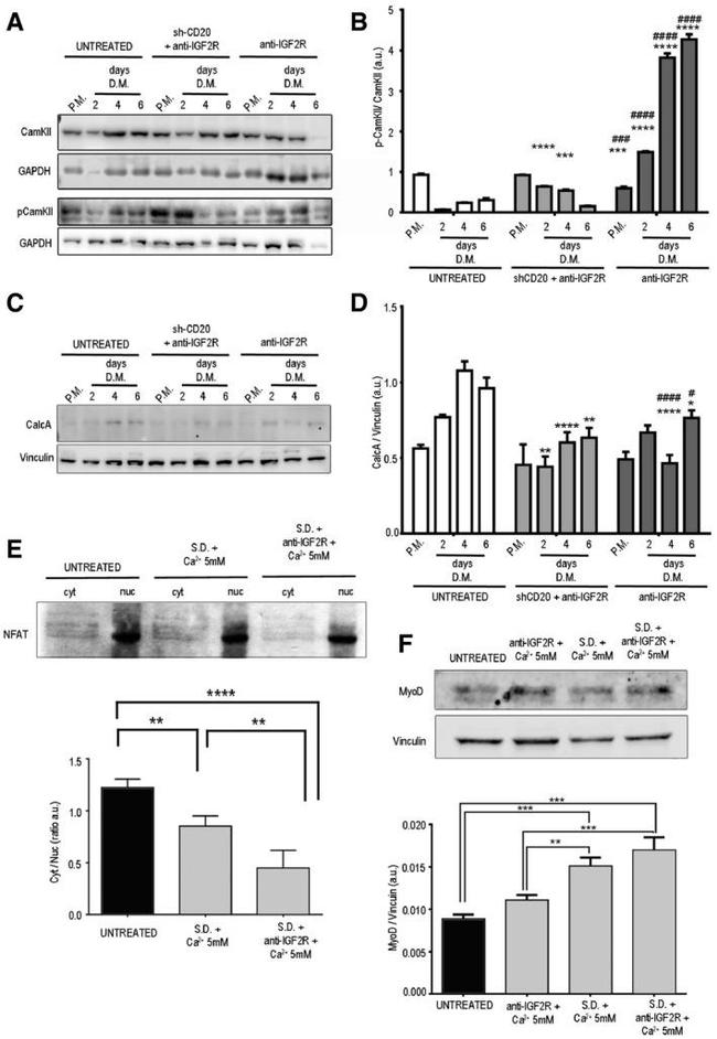 Phospho-CaMKII alpha (Thr286) Antibody in Western Blot (WB)