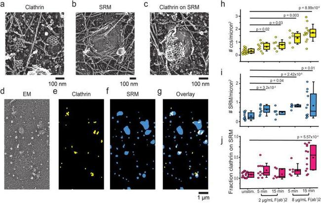 Clathrin Heavy Chain Antibody in Immunomicroscopy (IM)