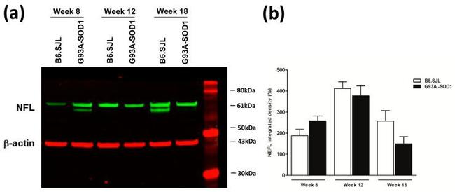 NEFL Antibody in Western Blot (WB)