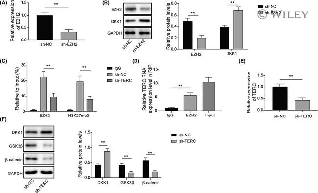 DKK1 Antibody in Western Blot (WB)