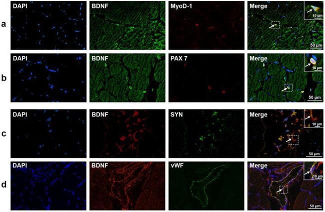 Synaptophysin Antibody in Immunohistochemistry (PFA fixed) (IHC (PFA))