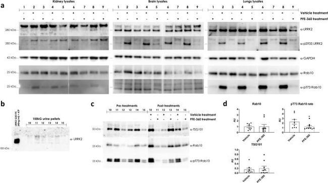 TSG101 Antibody in Western Blot (WB)