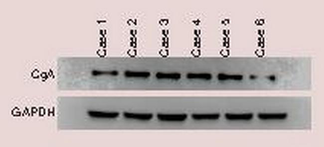 CGA Antibody in Western Blot (WB)