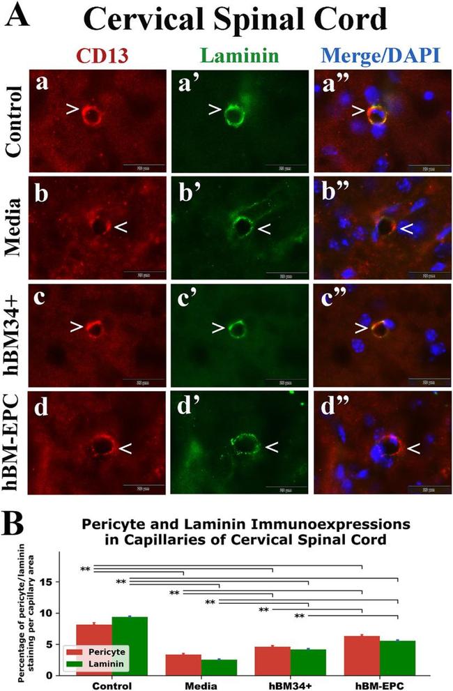 CD13 Antibody in Immunohistochemistry (IHC)