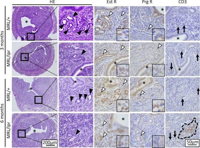 Progesterone Receptor Antibody in Immunohistochemistry (IHC)