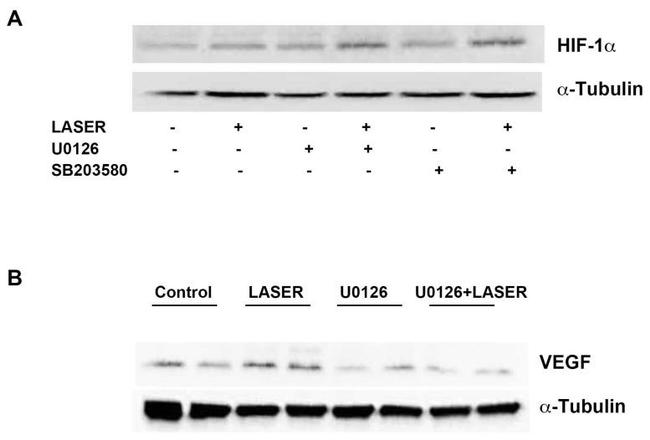 HIF1A Antibody in Western Blot (WB)