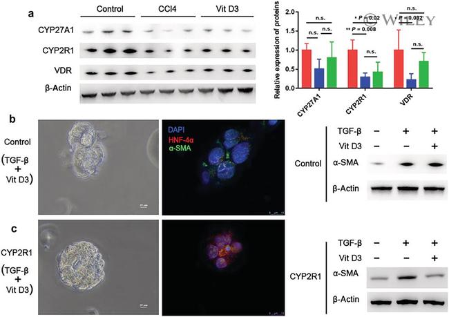 CYP2R1 Antibody in Western Blot (WB)