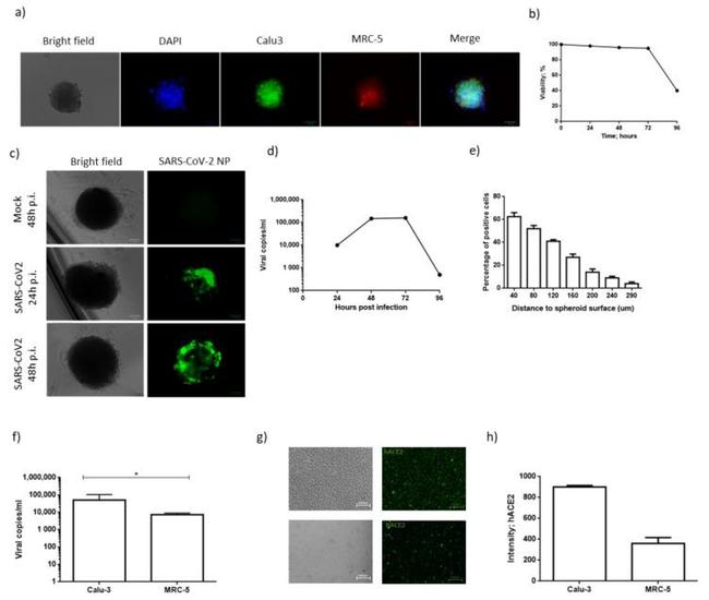 SARS/SARS-CoV-2 Nucleocapsid Antibody in Immunocytochemistry (ICC/IF)