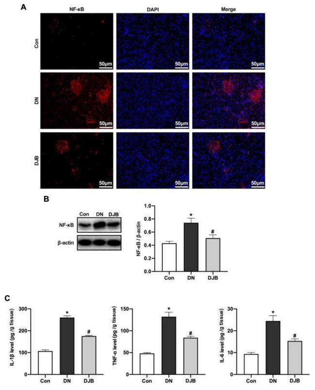 NFkB p65 Antibody in Immunohistochemistry (IHC)