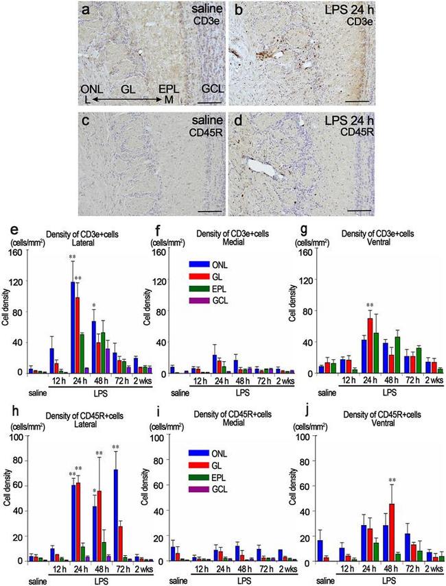 CD3e Antibody in Immunohistochemistry (IHC)