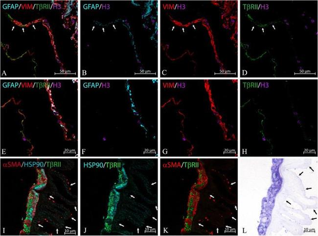 HSP90 alpha Antibody in Immunohistochemistry (Frozen) (IHC (F))