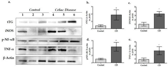 uNOS Antibody in Western Blot (WB)