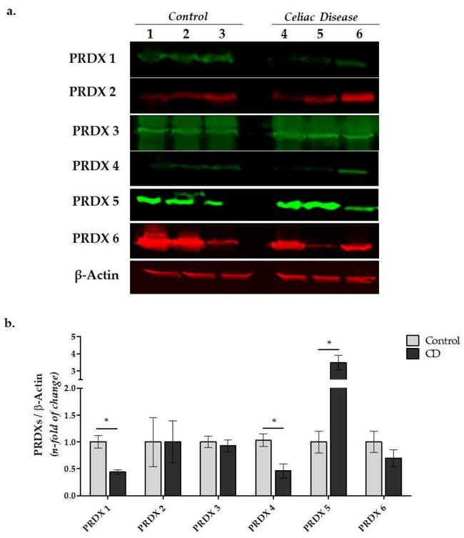 PRDX1 Antibody in Western Blot (WB)