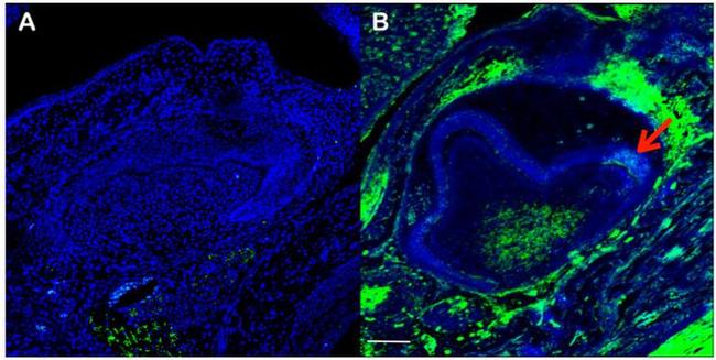 CaV1.1 Antibody in Immunohistochemistry (IHC)