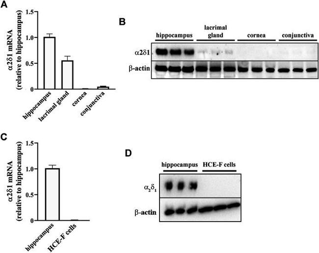 CACNA2D1 Antibody in Western Blot (WB)