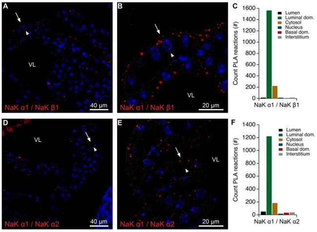 ATP1B1 Antibody in Immunohistochemistry (IHC)