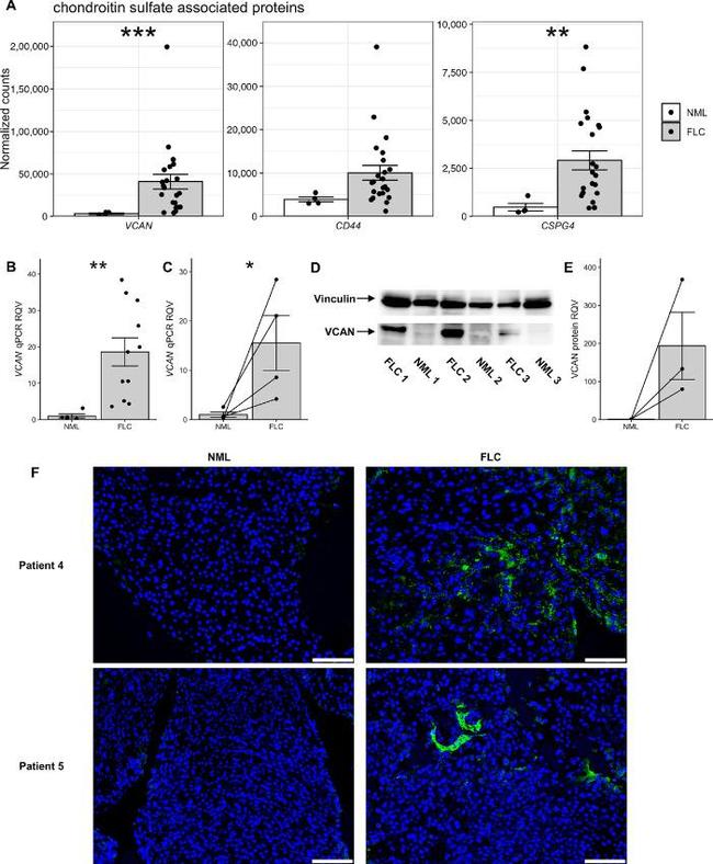 Vinculin Antibody in Western Blot (WB)