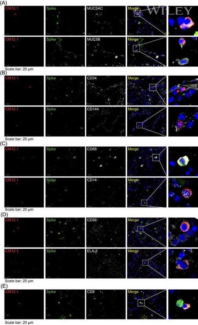 MUC5AC Antibody in Immunohistochemistry (IHC)