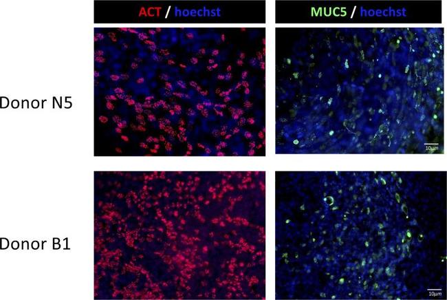 MUC5AC Antibody in Immunocytochemistry (ICC/IF)