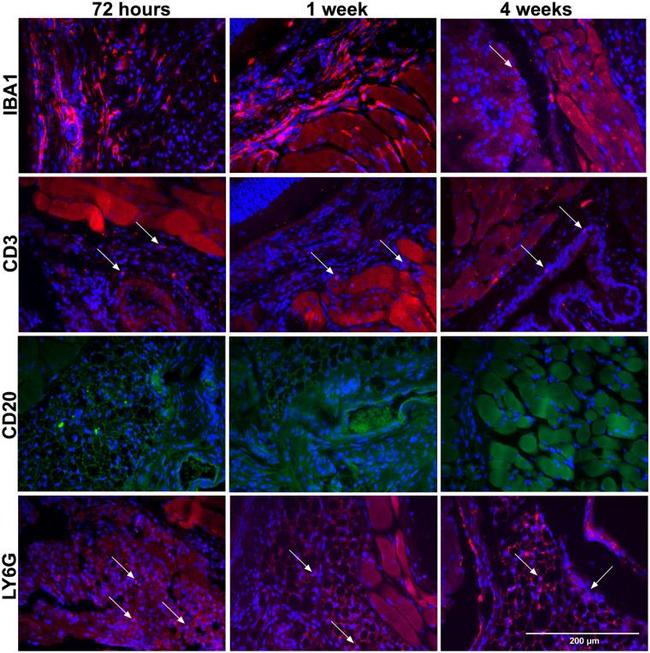 CD20 Antibody in Immunohistochemistry (Paraffin) (IHC (P))