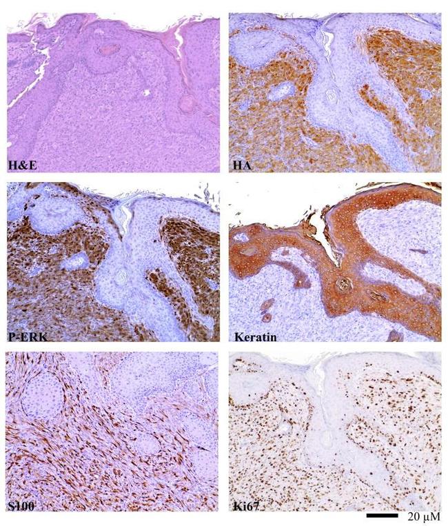 Cytokeratin Pan Antibody in Immunohistochemistry (IHC)