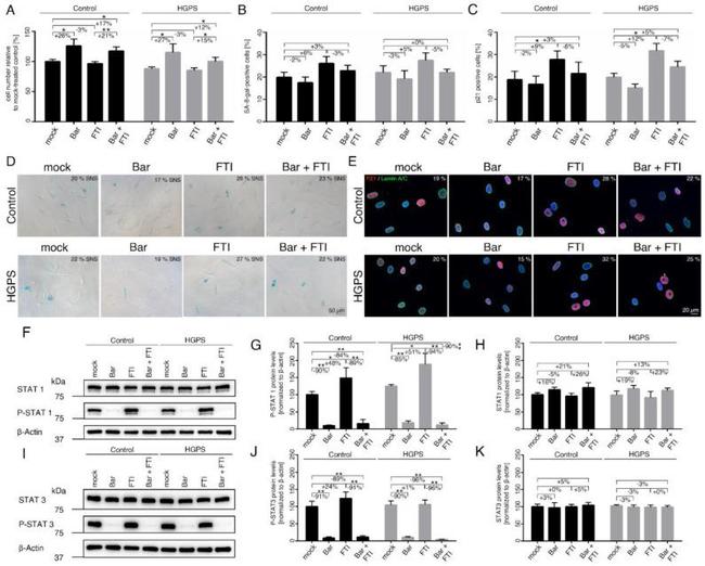 p21 Antibody in Immunocytochemistry (ICC/IF)