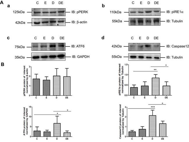 Phospho-PERK (Thr980) Antibody in Western Blot (WB)