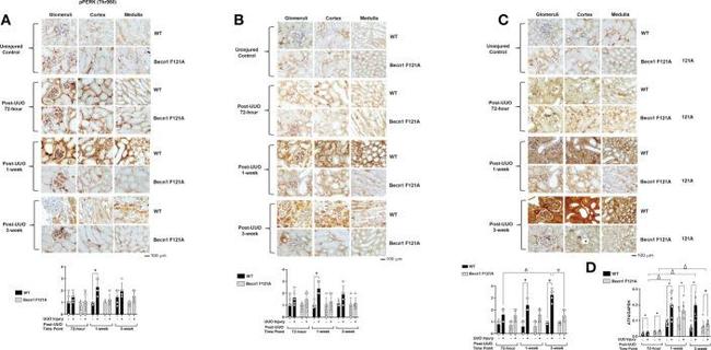 Phospho-PERK (Thr980) Antibody in Immunohistochemistry (IHC)