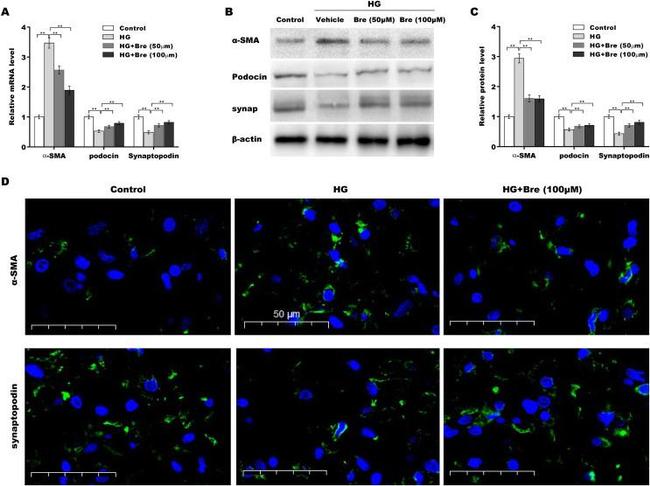 Podocin Antibody in Western Blot (WB)