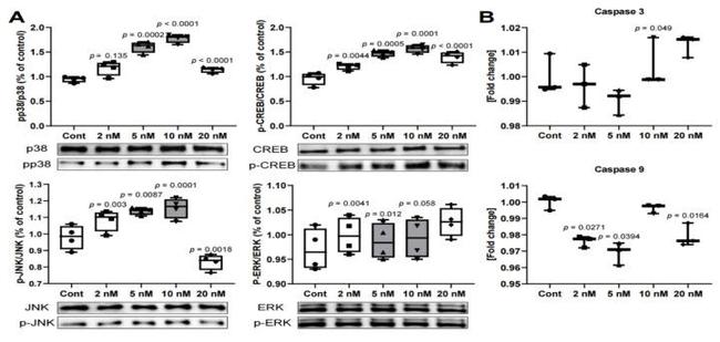 Phospho-p38 MAPK alpha (Thr180, Tyr182) Antibody in Western Blot (WB)