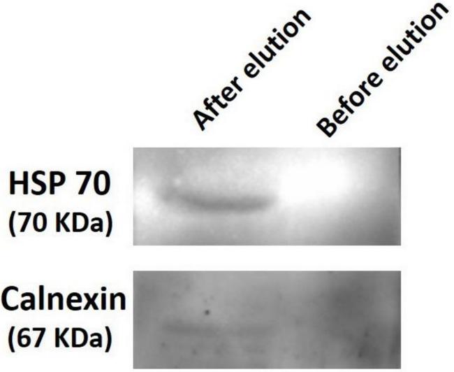 Calnexin Antibody in Western Blot (WB)