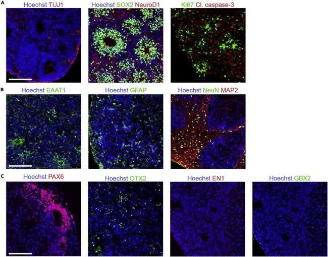 EN1 Antibody in Immunohistochemistry (IHC)