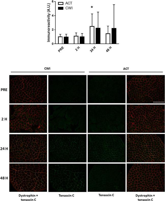 Tenascin C Antibody in Immunohistochemistry (IHC)