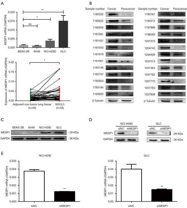 beta Tubulin Loading Control Antibody in Western Blot (WB)